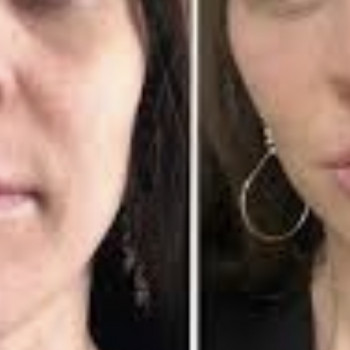 Фонофорез, аппаратная процедура для лица
                    Косметолог Елена Одесса