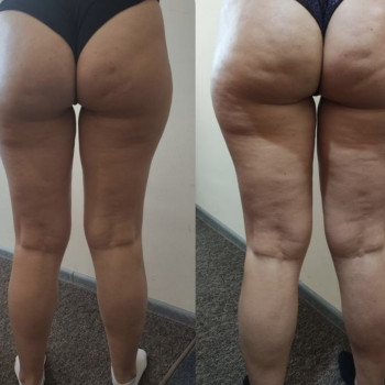 Тайский СПА Массаж тела ПАХОП
                    Косметолог Елена Одесса