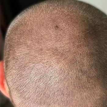 Трихопігментація
                    Мастер перманентного макияжа Ольга Днепр