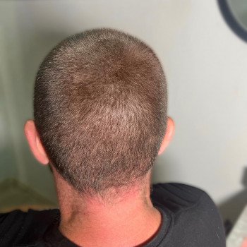 Трихопігментація
                    Мастер перманентного макияжа Ольга Днепр