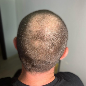 Трихопігментація
                    Мастер перманентного макияжа Ольга Днепр