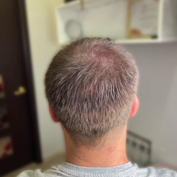 Трихопігментація
                    Мастер перманентного макияжа Ольга Днепр