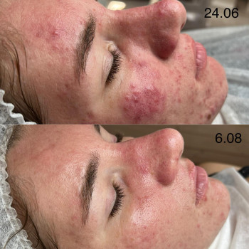 Мар’яна Білак, Ивано-Франковск Фото - 5