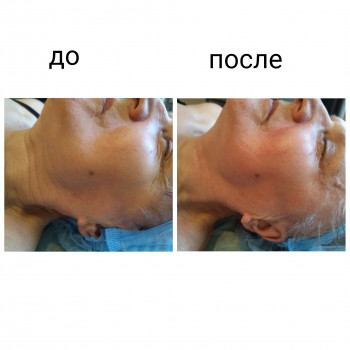 Скульптурирующий массаж лица, шеи и декольте