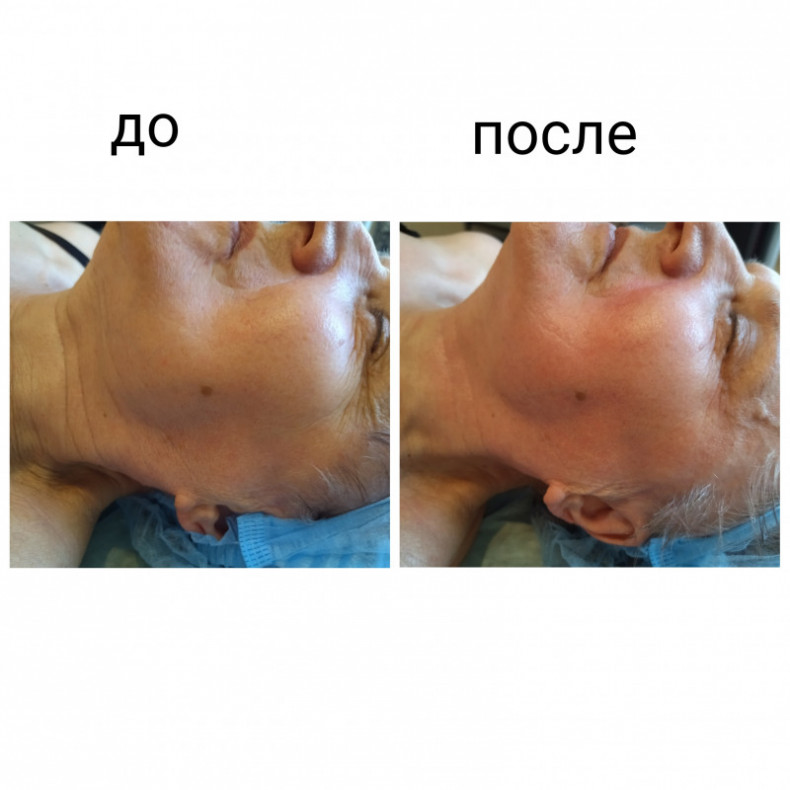 Скульптурирующий массаж лица, шеи и декольте, фото - Масажист Анна Юрьєва