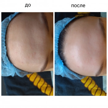 Скульптурирующий массаж лица, шеи и декольте