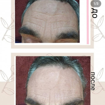 Скульптурирующий массаж лица, шеи и декольте