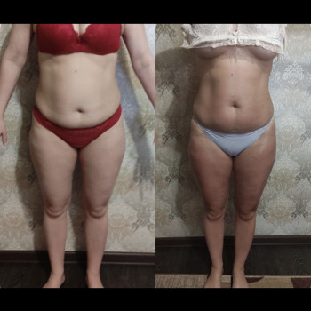 Обертывания/Пеленания для похудения
                    Косметолог Елена Одеса