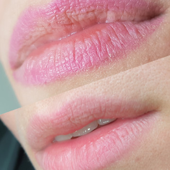 Лілія Решітко, Київ Фото - 9