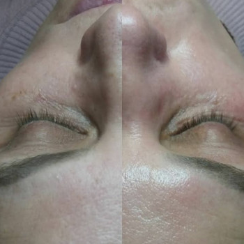 Ультразвукова чистка