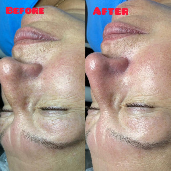 Вера Прудская, Бровары Фото - 41