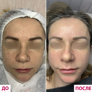 Лазерхауз, Львов Фото - 21