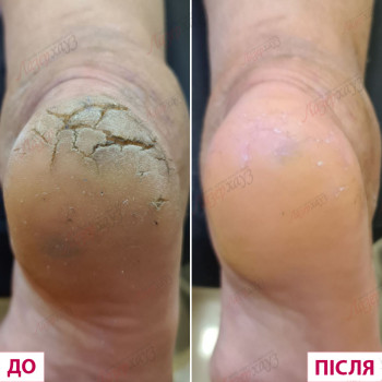 Лазерхауз, Кривой Рог Фото - 16