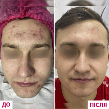 Лазерхауз, Кривой Рог Фото - 25