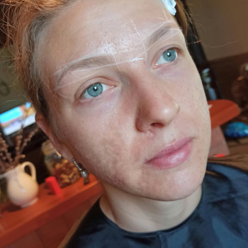 Комплекс ДУ 4в1
                    Бровіст Анна Одеса