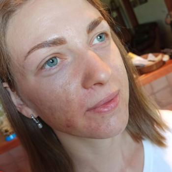 Комплекс ДУ 4в1
                    Бровіст Анна Одеса