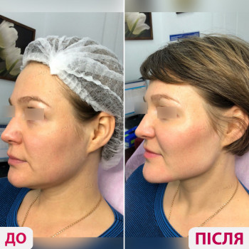 Лазерхауз, Ровно Фото - 9