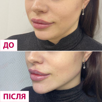 Лазерхауз, Житомир Фото - 11