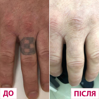 Лазерхауз, Кременчуг Фото - 13