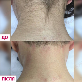 Лазерхауз, Кропивницкий Фото - 24