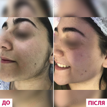 Лазерхауз, Кропивницкий Фото - 25