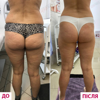 Лазерхауз, Тернополь Фото - 19