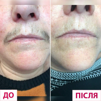 Лазерхауз, Чернівці Фото - 8