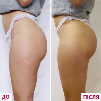 Лазерхауз, Чернівці Фото - 16