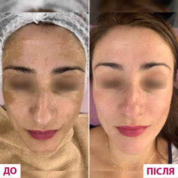 Лазерхауз, Чернівці Фото - 29