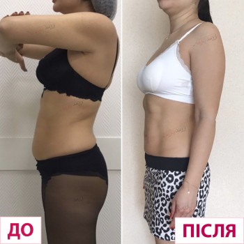 Лазерхауз, Мукачево Фото - 8