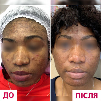 Лазерхауз, Мукачево Фото - 11