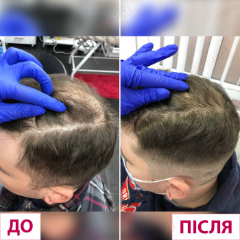 Лазерхауз, Мукачево Фото - 16