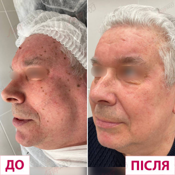 Лазерхауз, Мукачево Фото - 21