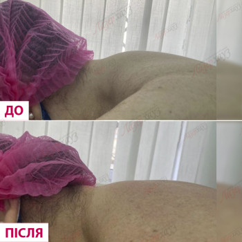 Лазерхауз, Мукачево Фото - 23