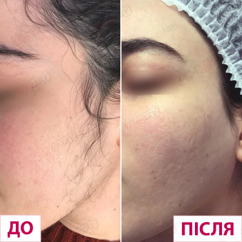 Лазерхауз, Павлоград Фото - 15