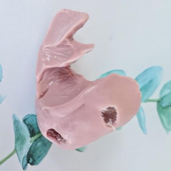 Удаление стержневой мозоли
                    Подолог Руслана Петровна Одеса