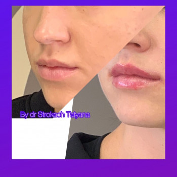 КосМед, Буча Фото - 5