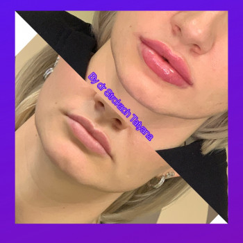 КосМед, Буча Фото - 6