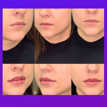 КосМед, Буча Фото - 7