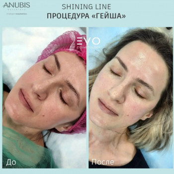 Процедура "Гейша"
                    Косметолог-ін'єкціоніст Надежда Київ