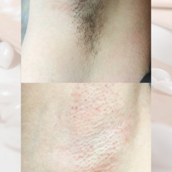 Вікторія Авдєєва, Кропивницкий Фото - 20