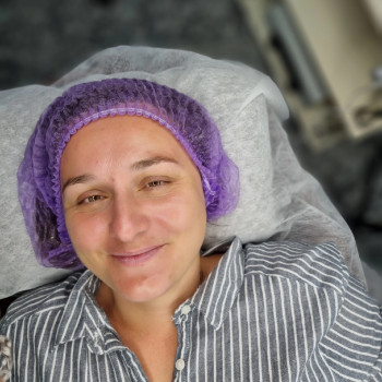 Чистка лица, Hydrofacial, ультразвуковая, механическая чистка
                    Косметолог-эстетист Влада Харьков