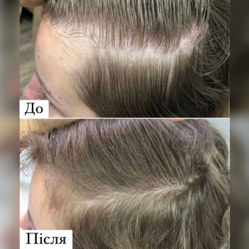 Іванна Рараговська, Калуш Фото - 16