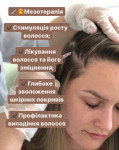 Мезотерапія волосся Косметолог-эстетист Тетяна Киев