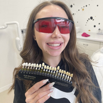 Косметичне відбілювання зубів
                    Масажист Марина Київ