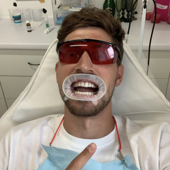 Косметичне відбілювання зубів
                    Масажист Марина Київ