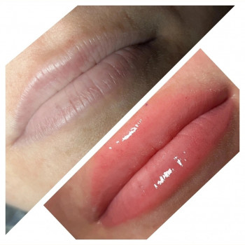 Лидия Перманент, Николаев Фото - 9