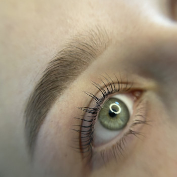 Загоєні брови та ботокс вій