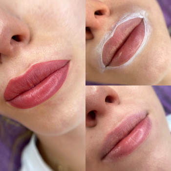 губи до / ескіз / після