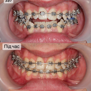 Наталія Витівська, Львів Фото - 27